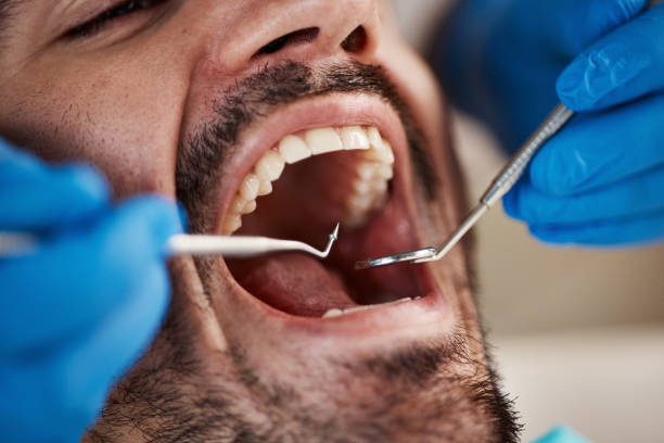 Best Dentist for Tooth Abscess  in Soldotna, AK